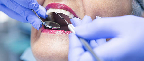 Best Broken or Chipped Tooth Repair in Oak Hills Pce, LA